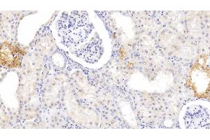 Immunohistochemistry (IHC) image for anti-Melatonin Receptor 1A (MTNR1A) (AA 296-350) antibody (ABIN7437158)