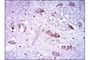 Immunohistochemical analysis of paraffin-embedded medulla oblongata tissues using NEFH mouse mAb with DAB staining.