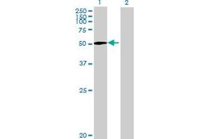 Western Blot analysis of ZNF549 expression in transfected 293T cell line by ZNF549 MaxPab polyclonal antibody. (ZNF549 antibody  (AA 1-640))