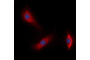Immunofluorescent analysis of HER3 staining in A549 cells. (ERBB3 antibody  (C-Term))