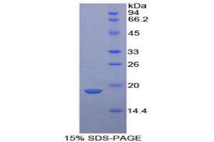 SDS-PAGE analysis of Human Neurotensin Protein.