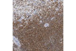 Immunohistochemical staining of human spleen with PSD4 polyclonal antibody  shows strong cytoplasmic positivity in cells of white pulp. (PSD4 antibody)