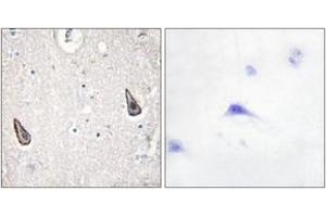 Immunohistochemistry analysis of paraffin-embedded human brain tissue, using ADCY5/6 Antibody. (ADCY5/6 antibody  (AA 931-980))