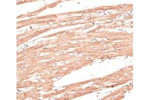 Immunohistochemistry of paraffin-embedded Rat heart using KIF1C Polyclonal Antibody at dilution of 1:100 (40x lens). (KIF1C antibody)