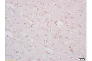 Formalin-fixed and paraffin embedded rat brain labeled with Anti-ST18/Znf387 Polyclonal Antibody, Unconjugated (ABIN1386039) at 1:200 followed by conjugation to the secondary antibody and DAB staining (ST18 antibody  (AA 451-550))