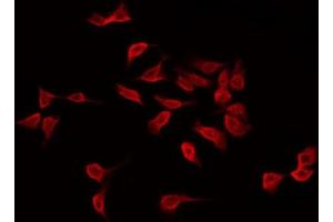 ABIN6274938 staining HepG2 by IF/ICC. (CAPN11 antibody  (Internal Region))