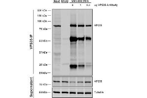 Immunoprecipitation analysis using Mouse Anti-VPS35 Monoclonal Antibody, Clone 7E4 (ABIN6932908).