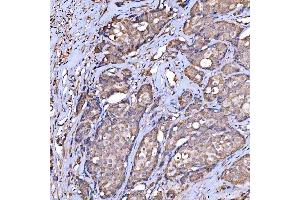 IHC analysis of Scavenging Receptor SRB2/SCARB2 using anti-Scavenging Receptor SRB2/SCARB2 antibody (ABIN7601833). (SCARB2 antibody  (AA 48-357))