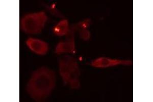 ABIN6275105 staining Hela cells by IF/ICC. (ELOVL1 antibody  (Internal Region))