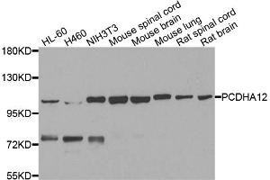 Western blot analysis of extracts of various cell lines, using PCDHA12 antibody. (PCDHA12 antibody)