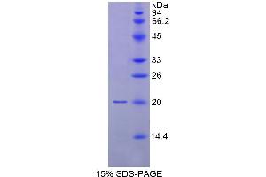SDS-PAGE analysis of Human MYL9 Protein. (MYL9 Protein)
