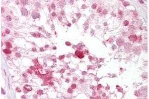 Anti-IFT88 antibody IHC staining of human testis. (IFT88 antibody  (N-Term))