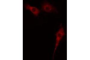 ABIN6274400 staining Hela cells by IF/ICC. (MAST2 antibody  (Internal Region))