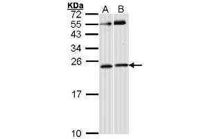 RAC1 antibody  (Center)