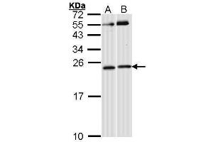 WB Image Sample (30 ug of whole cell lysate) A: Hela B: Raji 12% SDS PAGE antibody diluted at 1:1000 (RAC1 antibody  (Center))
