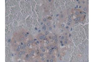 Immunohistochemistry (IHC) image for anti-Cerebral Dopamine Neurotrophic Factor (CDNF) (AA 20-183) antibody (ABIN7436288)
