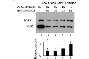 Western Blotting (WB) image for anti-Poly (ADP-Ribose) Polymerase 1 (PARP1) antibody (ABIN2854798)