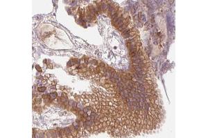 AMPK1 Antibody for IHC in human gallbladder tissue (PRKAA1 antibody  (C-Term))