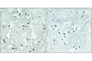 Immunohistochemistry analysis of paraffin-embedded human brain, using ELAC2 Antibody. (ELAC2 antibody  (AA 161-210))