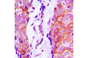 Immunohistochemical analysis of Cystatin 11 staining in human prostate formalin fixed paraffin embedded tissue section. (CST11 antibody  (Center))