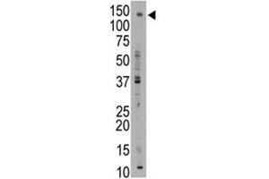 Western Blotting (WB) image for anti-ATP-Binding Cassette, Sub-Family B (MDR/TAP), Member 11 (ABCB11) (AA 1038-1067) antibody (ABIN3030049)