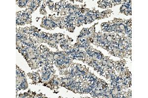 IHC analysis of Clathrin heavy chain/CLTC using anti-Clathrin heavy chain/CLTC antibody (ABIN7602703). (Clathrin Heavy Chain (CLTC) (AA 967-1668) antibody)