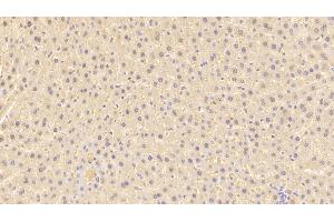 Detection of ARG in Rat Liver Tissue using Polyclonal Antibody to Arginase (ARG) (ARG antibody  (AA 1-323))
