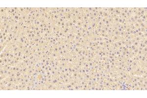 Detection of ARG in Rat Liver Tissue using Polyclonal Antibody to Arginase (ARG) (ARG antibody  (AA 1-323))