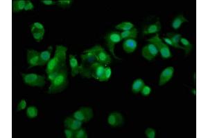 Immunofluorescence staining of MCF-7 cells with ABIN7142202 at 1:100, counter-stained with DAPI. (PSMD11 antibody  (Regulatory Subunit 11))