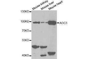 Western blot analysis of extracts of various cell lines, using AOC3 antibody. (AOC3 antibody  (AA 27-190))