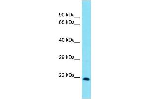 Host:  Rabbit  Target Name:  Msx3  Sample Type:  Rat Lung lysates  Antibody Dilution:  1. (Homeobox, Msh-Like 3 (MSX3) (C-Term) antibody)