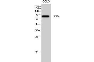 Western Blotting (WB) image for anti-Solute Carrier Family 39 (Zinc Transporter), Member 4 (SLC39A4) (Internal Region) antibody (ABIN3187537)