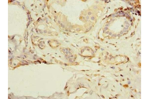 PSD4 antibody  (AA 1-300)