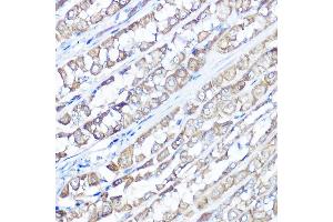 Immunohistochemistry of paraffin-embedded rat stomach using TRPV6 Rabbit pAb (ABIN7270921) at dilution of 1:100 (40x lens). (TRPV6 antibody  (AA 1-100))