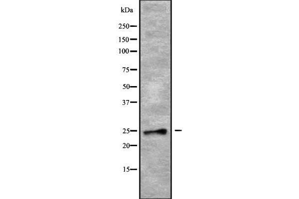 RAB28 antibody  (Internal Region)