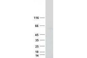 Validation with Western Blot (ZSCAN4 Protein (Myc-DYKDDDDK Tag))