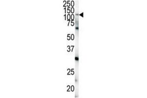 Western Blotting (WB) image for anti-EPH Receptor A4 (EPHA4) antibody (ABIN3003330)