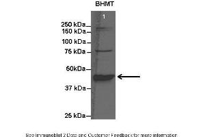 Western Blotting (WB) image for anti-Betaine--Homocysteine S-Methyltransferase (BHMT) (N-Term) antibody (ABIN2773785)