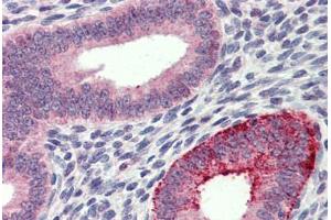 Uterus, Human: Formalin-Fixed, Paraffin-Embedded (FFPE) (FCHO1 antibody  (AA 468-517))