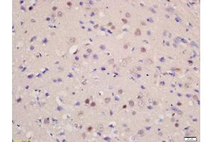 Formalin-fixed and paraffin embedded rat brain labeled with Rabbit Anti-SOD1 Polyclonal Antibody, Unconjugated  at 1:200 followed by conjugation to the secondary antibody and DAB staining (SOD1 antibody  (AA 6-100))