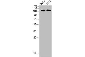 Western blot analysis of HELA 293T lysis using p52 S6 kinase antibody.