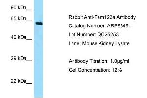 Western Blotting (WB) image for anti-APC Membrane Recruitment Protein 2 (AMER2) (N-Term) antibody (ABIN2786237) (AMER2 antibody  (N-Term))