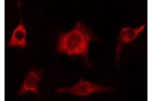 ABIN6274993 staining HeLa cells by IF/ICC. (CEP78 antibody  (Internal Region))