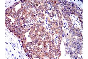 Image no. 2 for anti-Twinfilin, Actin-Binding Protein 1 (TWF1) antibody (ABIN1491429) (TWF1 antibody)