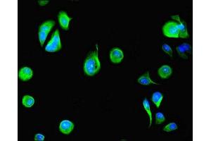 Immunofluorescent analysis of MCF-7 cells using ABIN7150796 at dilution of 1:100 and Alexa Fluor 488-congugated AffiniPure Goat Anti-Rabbit IgG(H+L) (DYRK4 antibody  (AA 201-520))