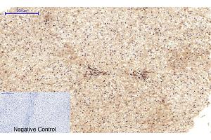 Immunohistochemical analysis of paraffin-embedded human liver tissue. (Cadherin 5 antibody  (Internal Region))