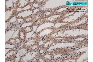 Formalin-fixed and paraffin embedded horse kidney labeled with Anti- HSD11B2 Polyclonal Antibody, Unconjugated at 1:200 followed by conjugation to the secondary antibody and DAB staining (HSD11B2 antibody  (AA 151-250))