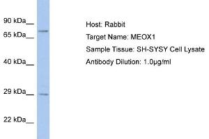Host: Rabbit Target Name: MEOX1 Sample Tissue: Human SH-SYSY Whole Cell  Antibody Dilution: 1ug/ml (MEOX1 antibody  (C-Term))