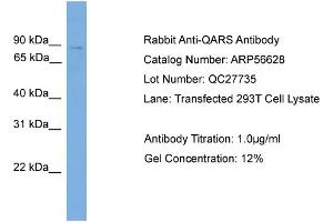 Western Blotting (WB) image for anti-Glutaminyl-tRNA Synthetase (QARS) (N-Term) antibody (ABIN2786804) (QARS antibody  (N-Term))