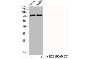 Western Blot analysis of HELA HepG2 cells using Phospho-Cortactin (Y466) Polyclonal Antibody (Cortactin antibody  (pTyr466))
